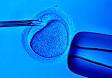 In-vitro Fertilization