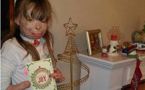 Want To Send This Little Girl A Christmas Card?