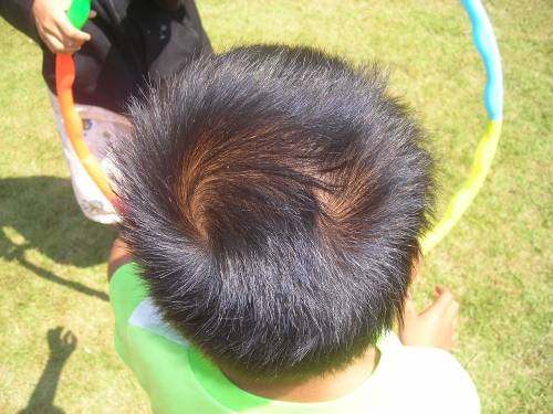 Cowlick