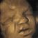 Discuss  Babies In Womb Sense Touch Pain