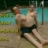   World' s Oldest Conjoined Twins