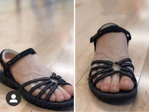 Sandals For Women With Ugly Feet?
