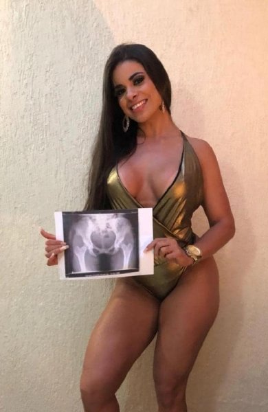 Brazil’s Miss Bumbum Competition