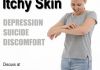 Discuss  Chronically Itchy Skin = Suicide Depression